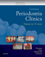 Title: Carranza Periodontia Clínica, Author: Newman Newman