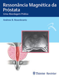 Title: Ressonância Magnética da Próstata: Uma abordagem Prática, Author: Andrew B. Rosenkrantz