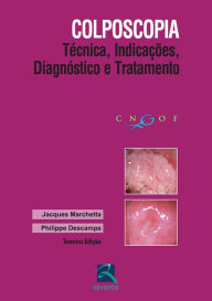 Title: Colposcopia: Técnica, indicações, diagnóstico e tratamento, Author: Jacques Marchetta