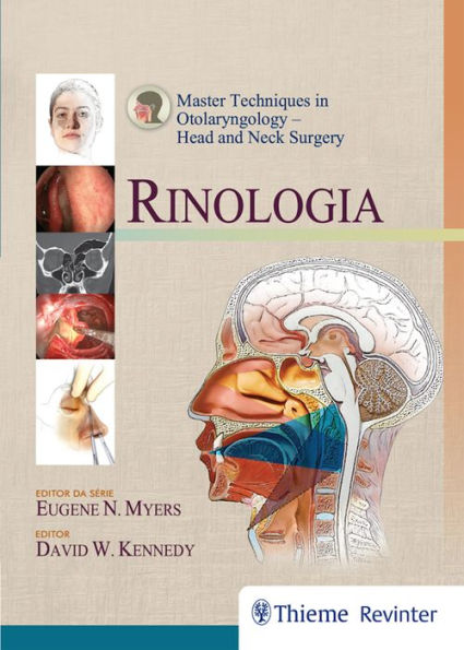 Rinologia: Master Techniques In Otolaryngology - Head And Neck Surgery