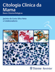 Title: Citologia Clínica da Mama: Bases Citomorfológicas, Author: Jacinto da Costa Silva Neto