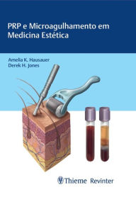 Title: PRP e Microagulhamento em Medicina Estética, Author: Amelia K. Hausauer