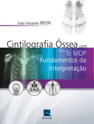 Title: Cintilografia óssea com 99mTc MDP: Fundamentos da interpretação, Author: João Eduardo Irion