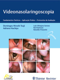 Title: Videonasolaringoscopia: Fundamentos teóricos - aplicação prática - protocolos de avaliação, Author: Domingos Hiroshi Tsuji