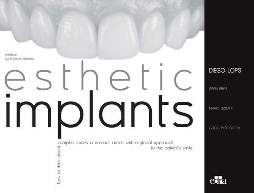 Esthetic Implants How to Think about Complex Cases in Anterior Areas with a Global Approach to the Patient Smile (2 Books)