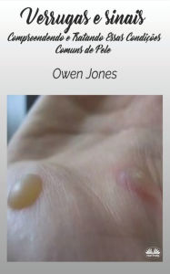Title: Verrugas e Sinais: Entendendo e Tratando Essas Doenï¿½as de Pele Comuns, Author: Owen Jones