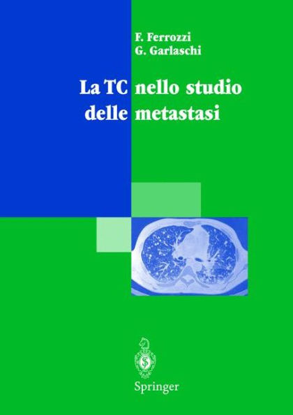 La TC nello studio delle metastasi / Edition 1