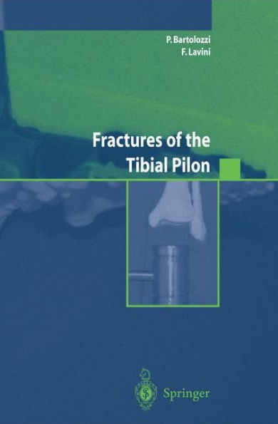 Fractures of the Tibial Pilon / Edition 1