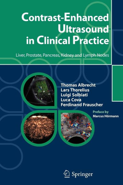 Contrast-Enhanced Ultrasound in Clinical Practice: Liver, Prostate, Pancreas, Kidney and Lymph Nodes / Edition 1