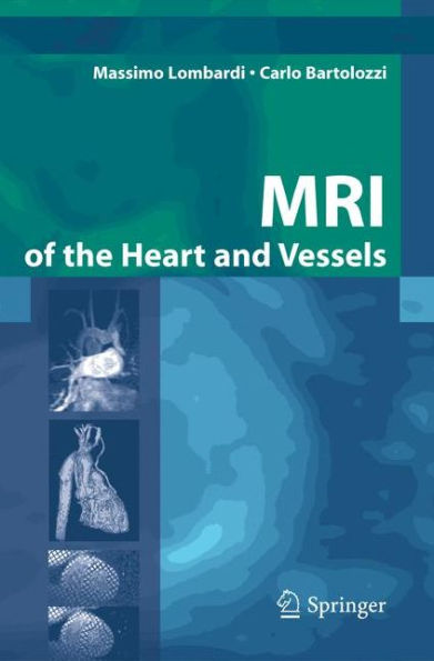 MRI of the Heart and Vessels / Edition 1