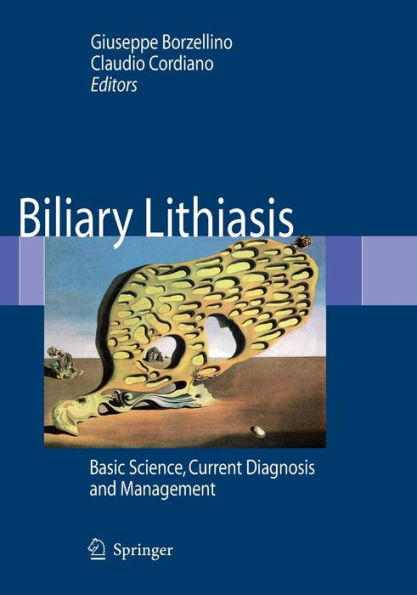 Biliary Lithiasis: Basic Science, Current Diagnosis and Management / Edition 1