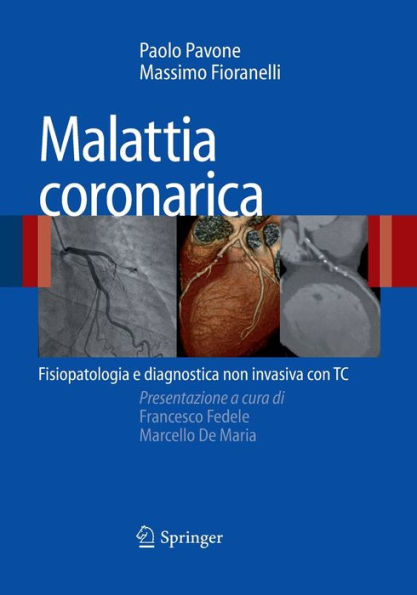 Malattia coronarica: Fisiopatologia e diagnostica non invasiva con TC / Edition 1