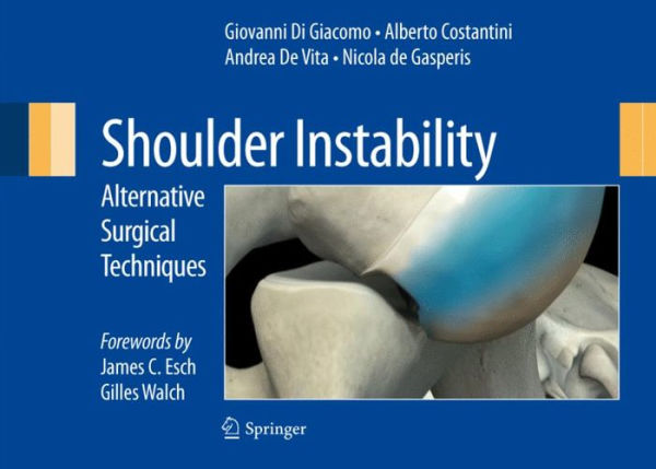 Shoulder Instability: Alternative Surgical Techniques / Edition 1