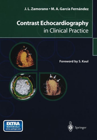 Contrast Echocardiography in Clinical Practice