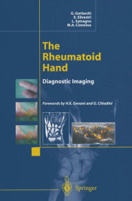 Title: The Rheumatoid Hand: Diagnostic Imaging, Author: G. Garlaschi