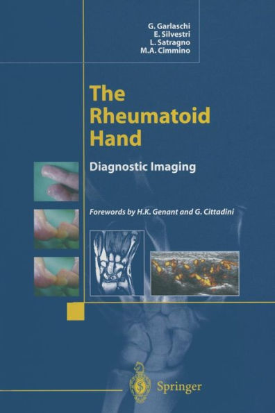 The Rheumatoid Hand: Diagnostic Imaging / Edition 1