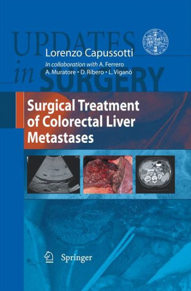 Surgical Treatment of Colorectal Liver Metastases / Edition 1