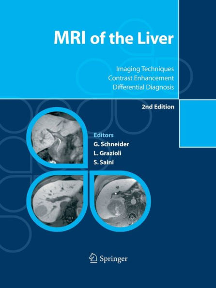 MRI of the Liver: Imaging Techniques, Contrast Enhancement, Differential Diagnosis