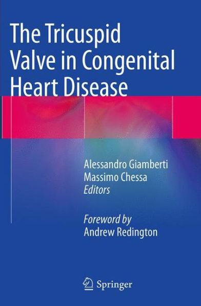 The Tricuspid Valve in Congenital Heart Disease