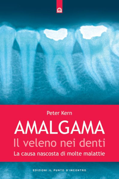 Amalgama: il veleno nei denti: La causa nascosta di molte malattie