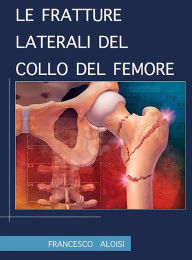 Title: Le fratture laterali del collo del femore, Author: Francesco Aloisi