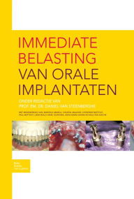 Title: Immediate belasting van orale implantaten, Author: D. Steenberghe