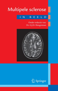 Title: Multipele sclerose in beeld, Author: G.J.D. Hengstman