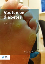 Title: Voeten en diabetes, Author: Margreet van Putten