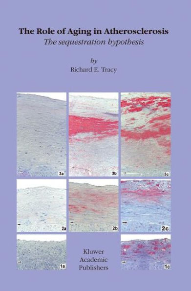 The Role of Aging in Atherosclerosis: The Sequestration Hypothesis / Edition 1