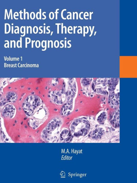 Methods of Cancer Diagnosis, Therapy and Prognosis: Breast Carcinoma / Edition 1