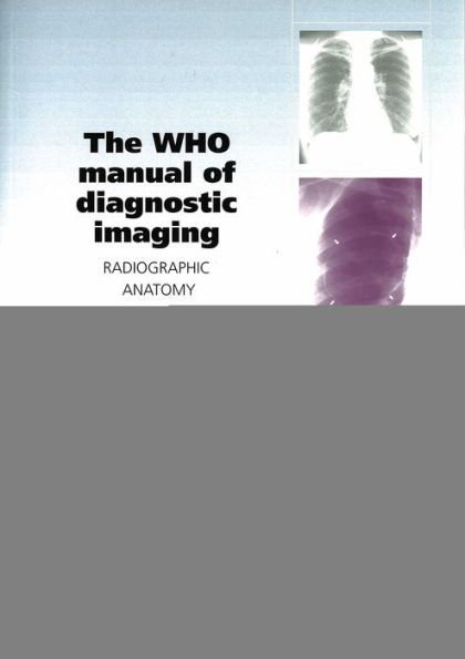 The WHO Manual of Diagnostic Imaging: Radiographic Anatomy and Interpretation of the Chest