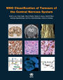 WHO Classification of Tumours of the Central Nervous System [OP]