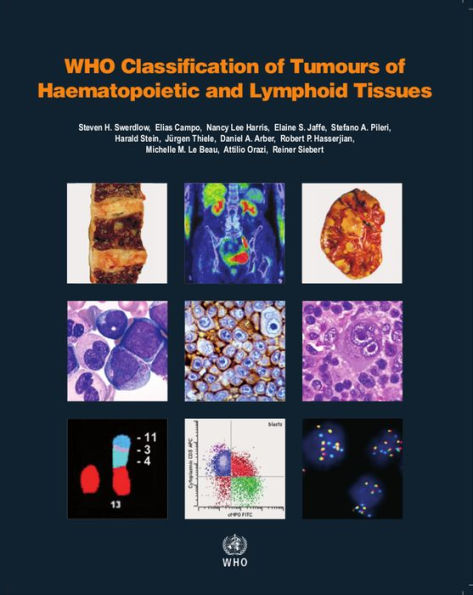 WHO Classification of Tumours of Haematopoietic and Lymphoid Tissues / Edition 4