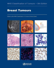 Best free ebook downloads kindle Breast Tumours / Edition 5 by WHO Classification of Tumours Editorial Board 9789283245001 in English