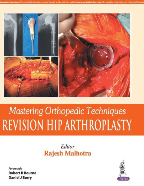 Mastering Orthopedic Techniques: Revision Hip Arthroplasty