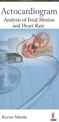 Actocardiogram : Analysis of Fetal Motion and Heart Rate