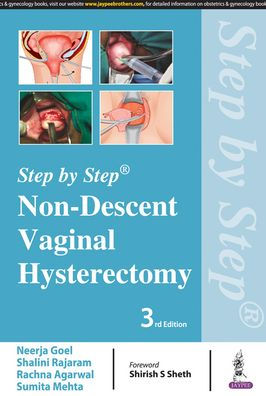 Non-Descent Vaginal Hysterectomy