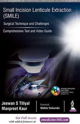Small Incision Lenticule Extraction (SMILE) : Surgical Technique and Challenges
