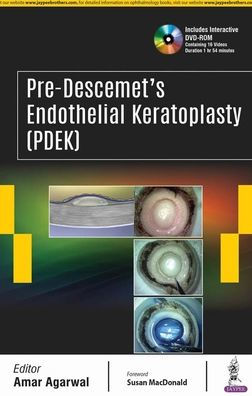 Pre-Descemet's Endothelial Keratoplasty (Pdek)