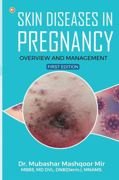 SKIN DISEASES IN PREGNANCY: OVERVIEW AND MANAGEMENT