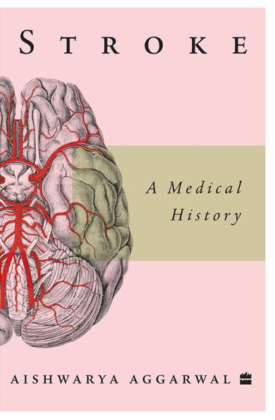 Stroke: A Medical History