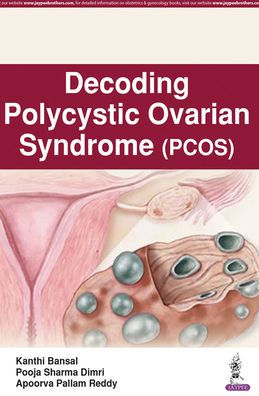 Decoding Polycystic Ovarian Syndrome