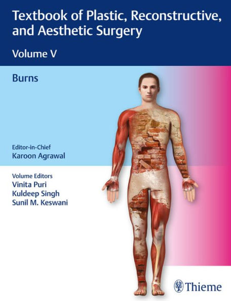 Textbook of Plastic, Reconstructive, and Aesthetic Surgery, Vol 5: Burns