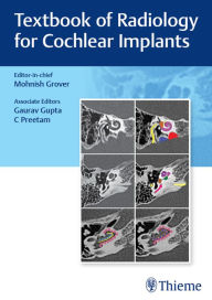 Title: Textbook of Radiology for Cochlear Implants, Author: Mohnish Grover