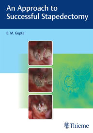 Title: An Approach to Successful Stapedectomy, Author: B. M. Gupta