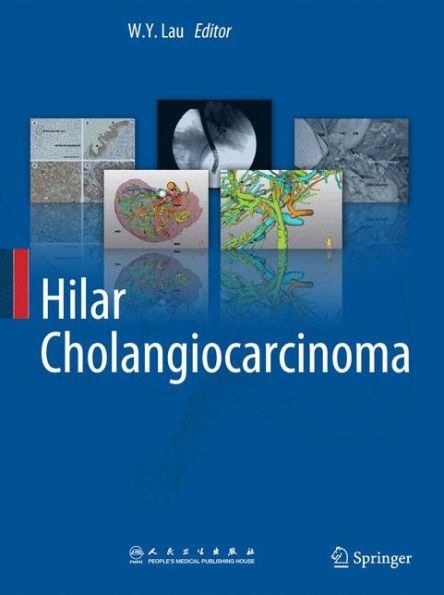 Hilar Cholangiocarcinoma / Edition 1