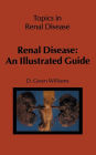 Renal Disease: An Illustrated Guide