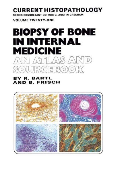 Biopsy of Bone in Internal Medicine: An Atlas and Sourcebook