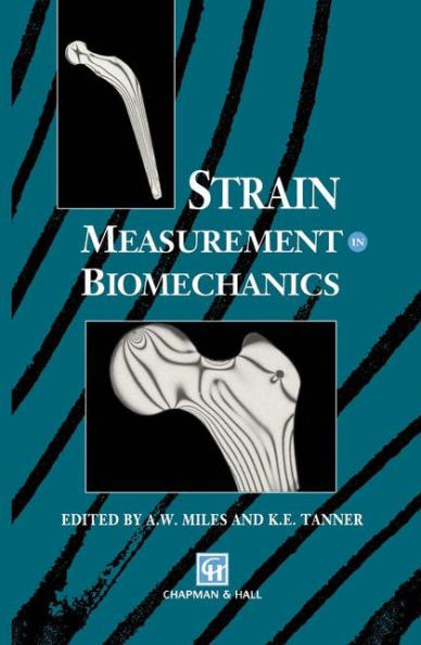 Strain Measurement in Biomechanics