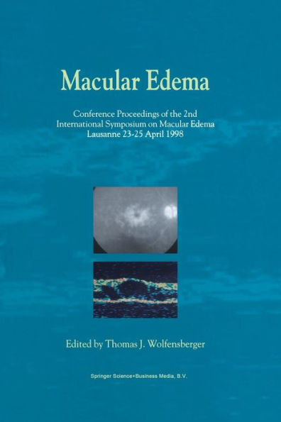 Macular Edema: Conference Proceedings of the 2nd International Symposium on Macular Edema, Lausanne, 23-25 April 1998